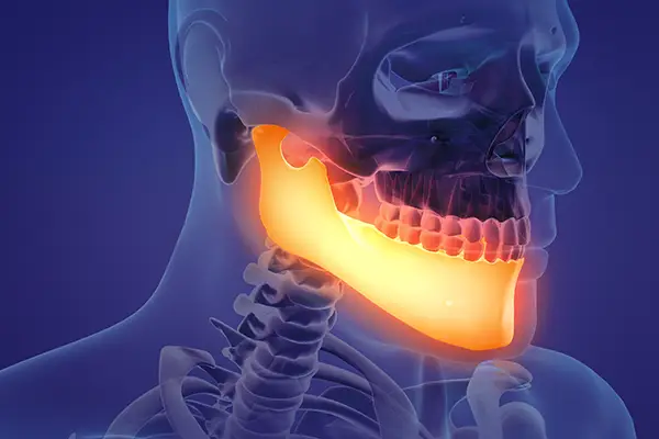 An x-ray view of the skull, the lower mandible highlighted in orange to represent a potential nomination for surgery.